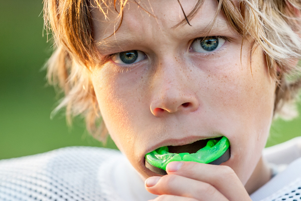 Custom Sports Guard mouthguards from Linglestown Family Dental in Harrisburg, PA