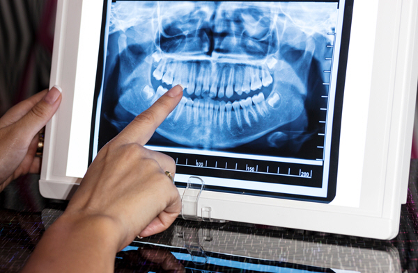 Digital X-rays at Linglestown Family Dental in Harrisburg PA