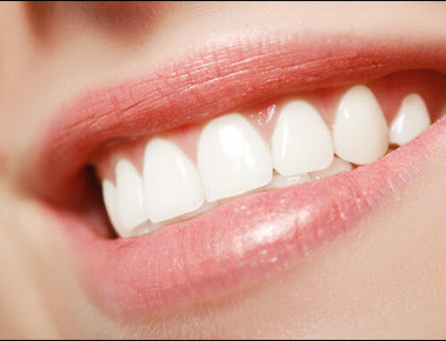 Popular Cosmetic Dentistry Choices