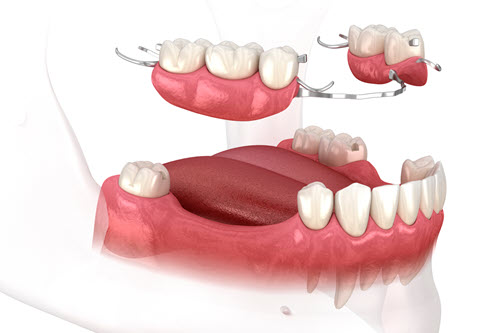 Prosthodontic Dentistry