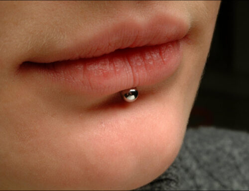 Mouth Piercings and Dental Risks