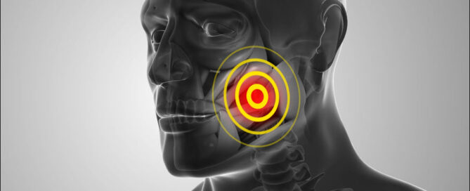 TMJ Disorder