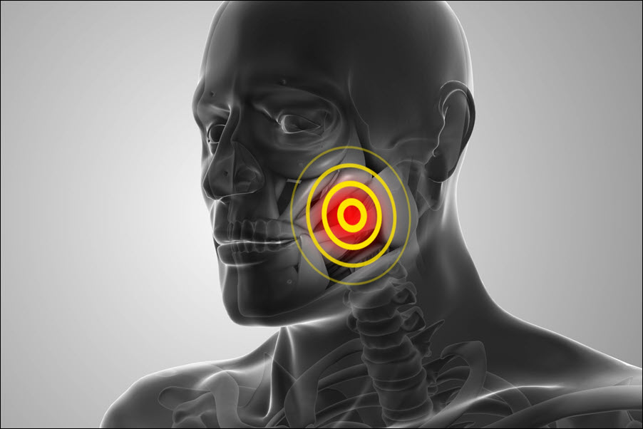 TMJ Disorder