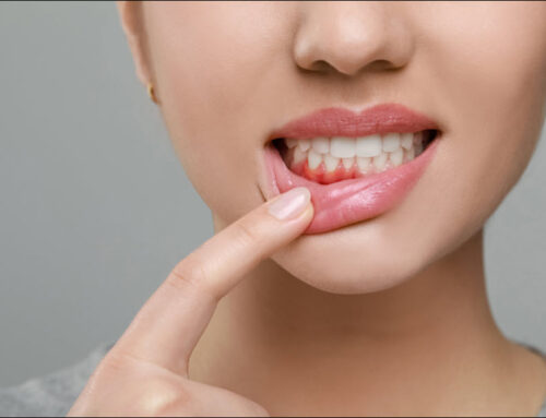 Best Practices for Preventing Gum Disease