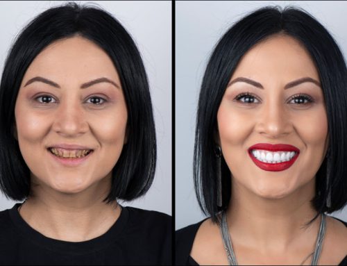 Modern Advances in Cosmetic Dentistry: Transform Your Smile