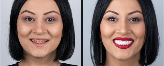Cosmetic